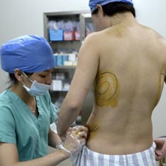 Китаянка нашла пропавшую грудь на спине