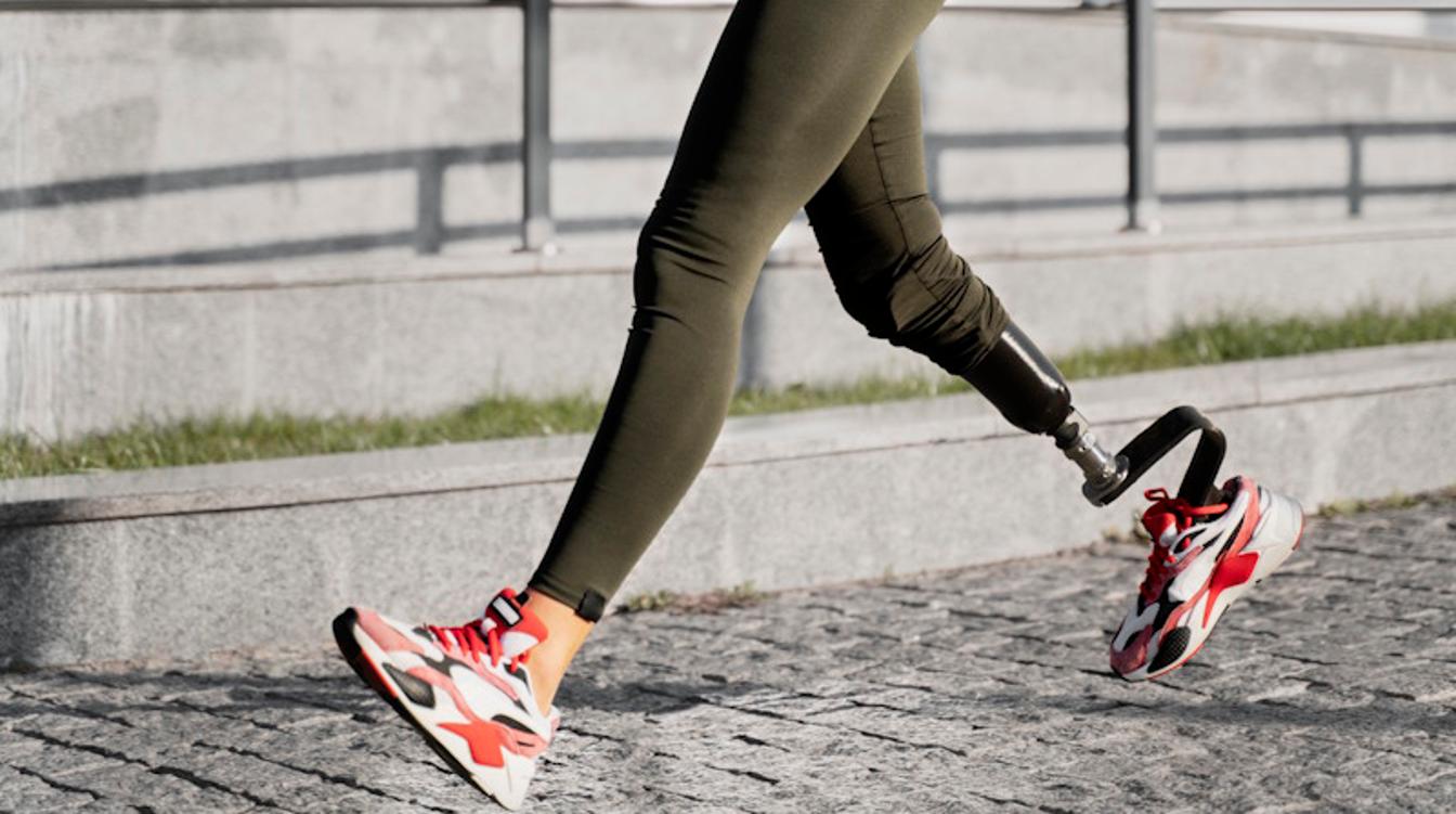 Британка списала смертельную болезнь на обычную простуду и лишилась ноги