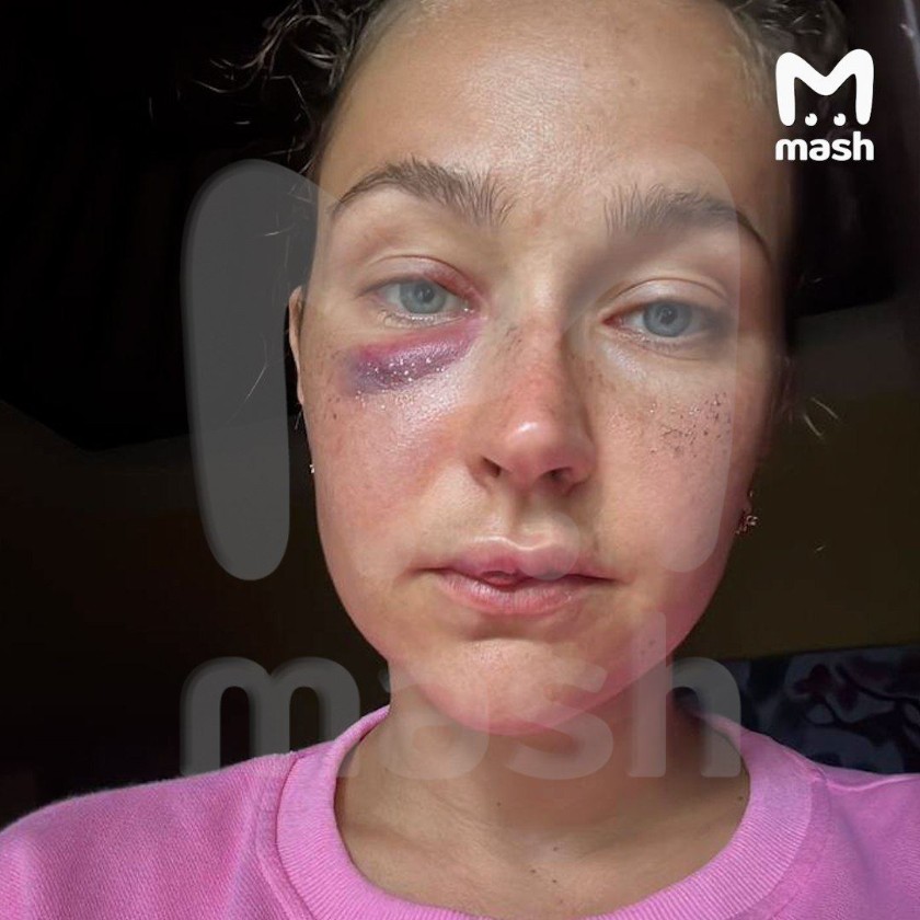 Татьяна Виноградова. Фото: Telegram, канал "MASH"